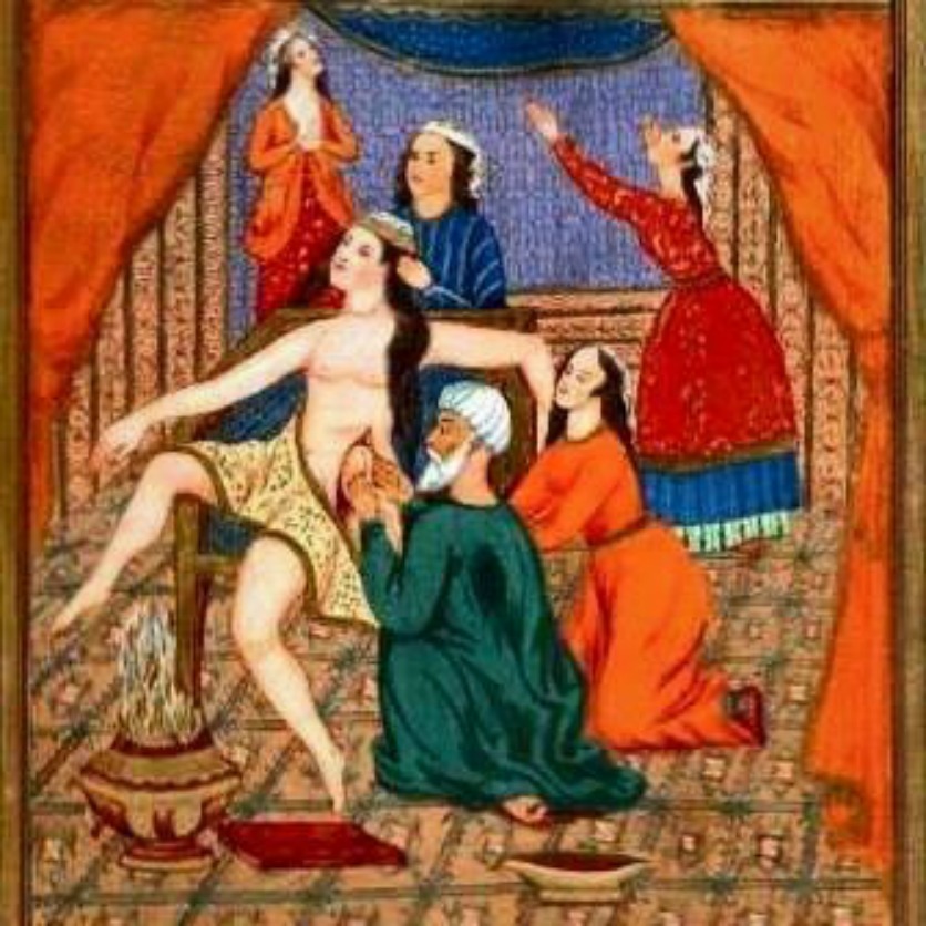 Antik İranda sezaryen doğumu resmi..